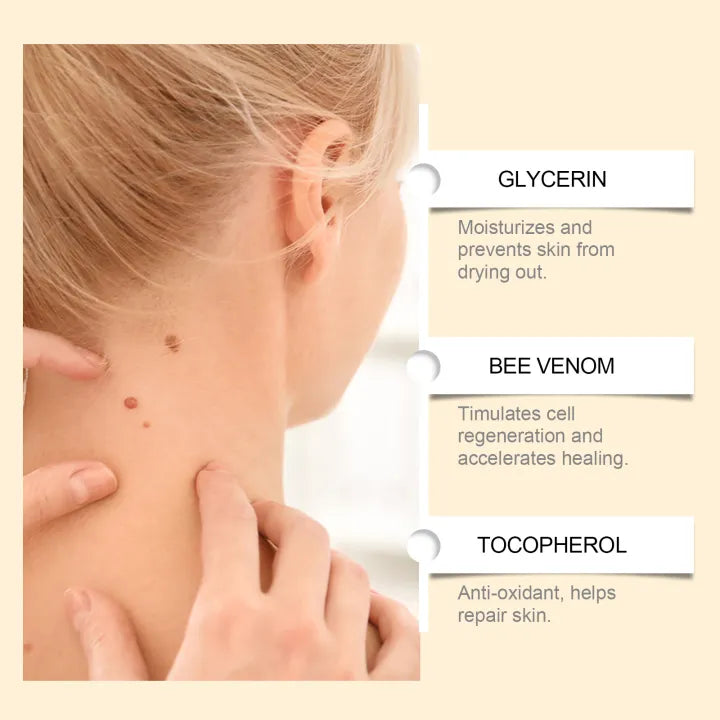 SouthMoon™ Bee Venom Mole & Wart Soothing Cream ( BUY 1 GET 1 FREE )