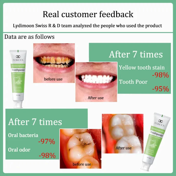 LYDIMOON Whitening toothpaste ( BUY 1 GET 1 FREE )