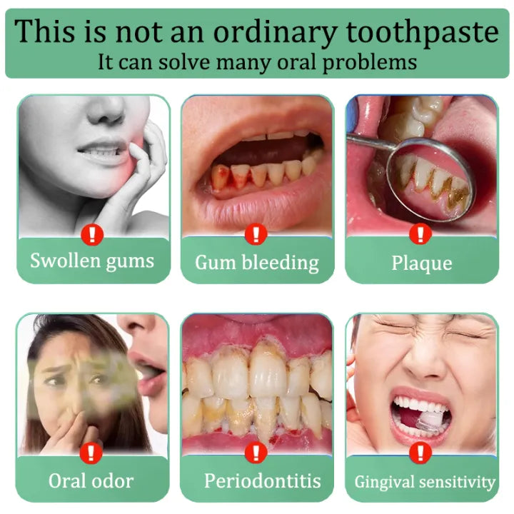LYDIMOON Whitening toothpaste ( BUY 1 GET 1 FREE )