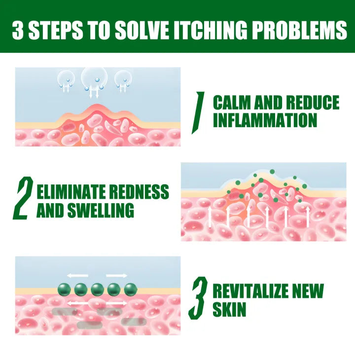 South Moon Eczema Cream ( BUY 1 GET 1 FREE )