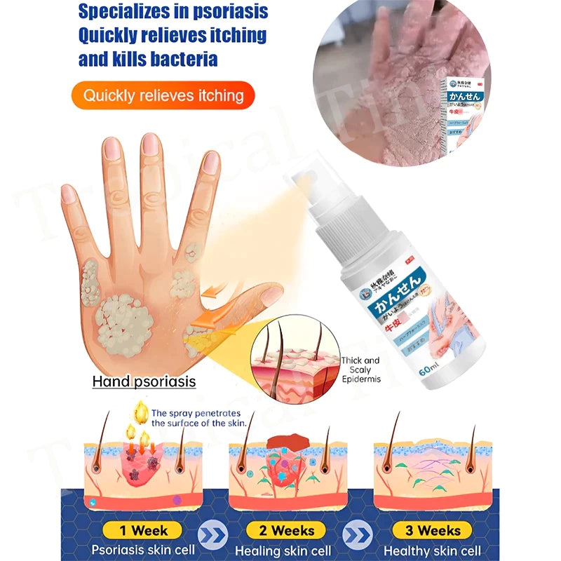 Japanese psoriasis spray ( BUY 1 GET 1 FREE )