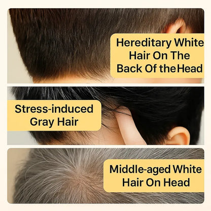 Handmade Herbal  Hair Growth Soap ( BUY 1 GET 1 FREE )