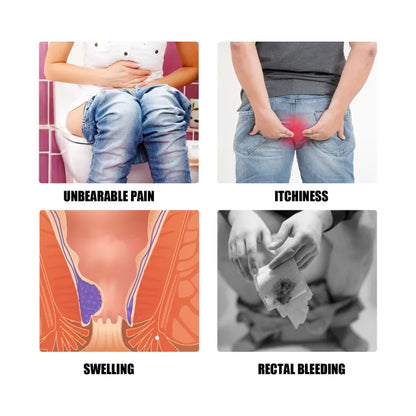 South Moon Hemorrhoids Relief Cream ( BUY 1 GET 1 FREE )