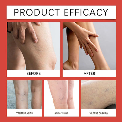 Veinless™ Immediate Relief Patch ( BUY 1 GET 1 FREE )