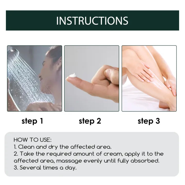 South Moon Psoriasis Cream ( BUY 1 GET 1 FREE )