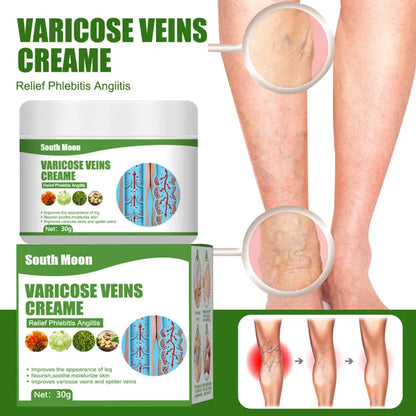 South Moon Varicose Vein Cream ( BUY 1 GET 1 FREE )