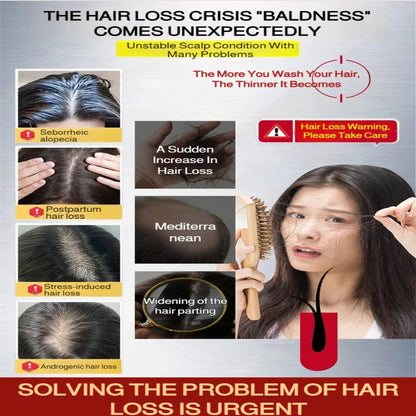 Handmade Herbal  Hair Growth Soap ( BUY 1 GET 1 FREE )