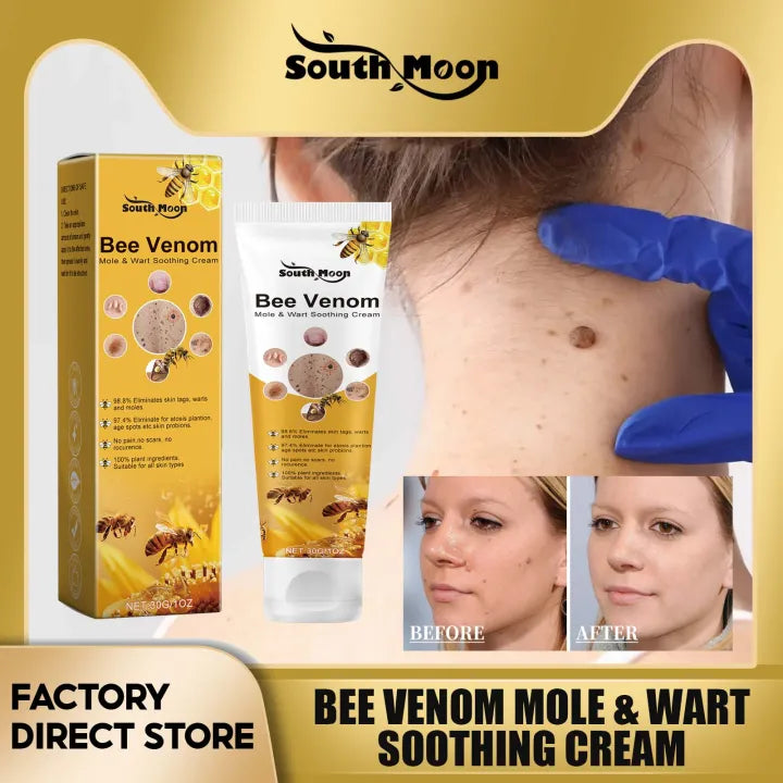 SouthMoon™ Bee Venom Mole & Wart Soothing Cream ( BUY 1 GET 1 FREE )