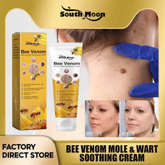 SouthMoon™ Bee Venom Mole & Wart Soothing Cream ( BUY 1 GET 1 FREE )