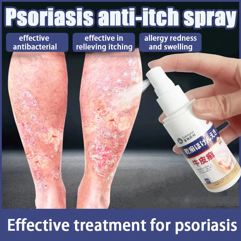 Imported japan Psoriasis Anti - Itch Spray
