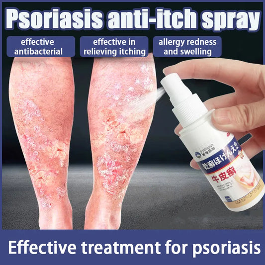 Imported japan Psoriasis Anti - Itch Spray