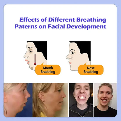 Pack Of 30 - Mouth Correction Sticker Night Breathing Patch