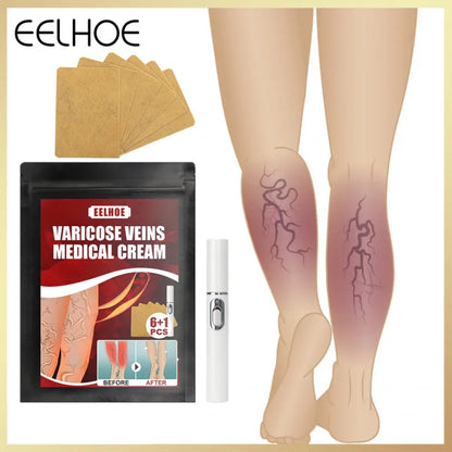 Eelhoe™ Varicose Veins Patches ( BUY 1 GET 1 FREE )