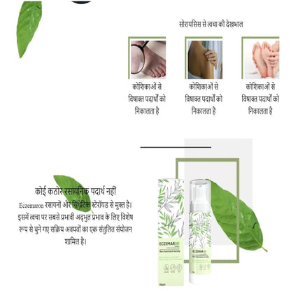 South Moon Psoriasis Moisturizing Cream ( BUY 1 GET 1 FREE )