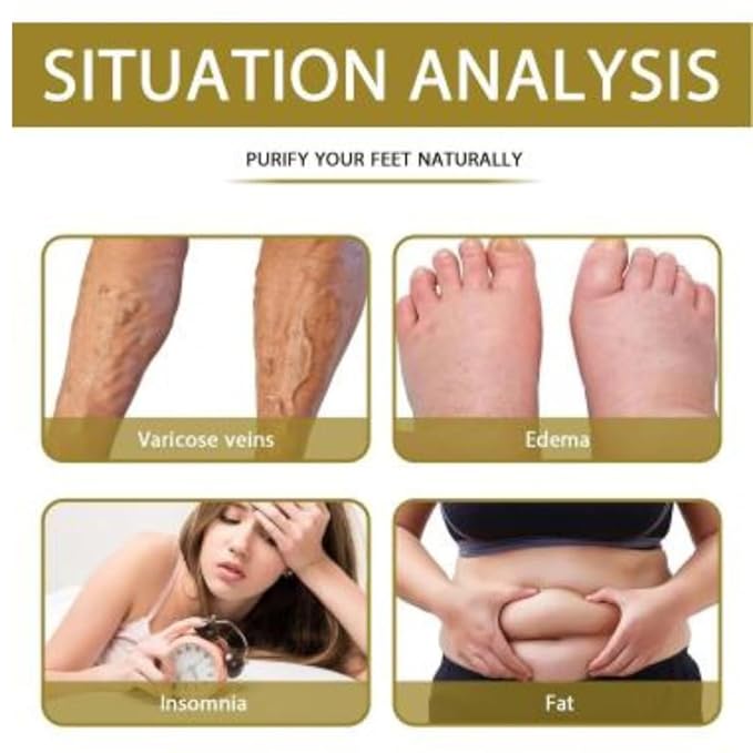 South Moon Bee Venom Drainage Body Shaping Patch ( BUY 1 GET 1 FREE )