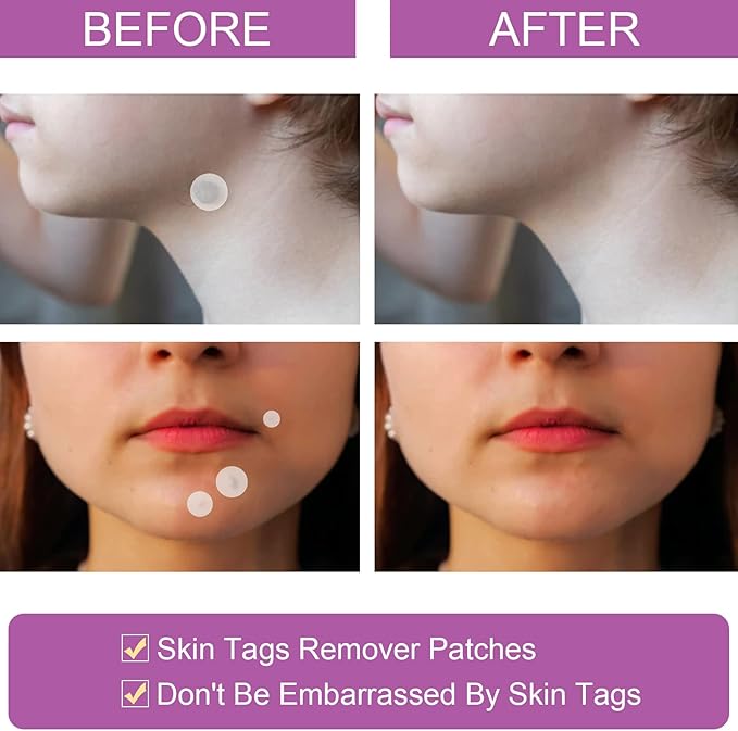 Fenxland™ Skin Care One Step Patch ( BUY 1 GET 1 FREE )