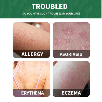 Psorilax - Cream for Psoriasis Treatment ( BUY 1 GET 1 FREE )