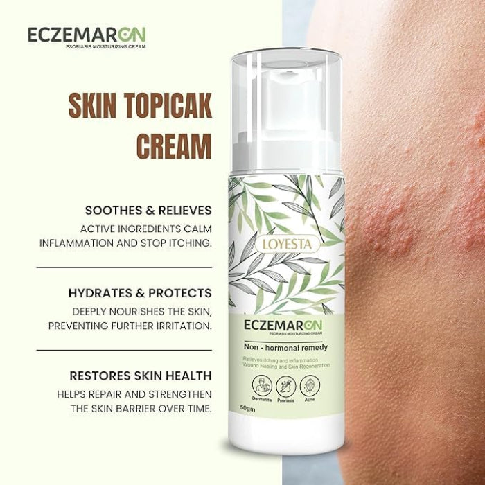 South Moon Psoriasis Moisturizing Cream ( BUY 1 GET 1 FREE )