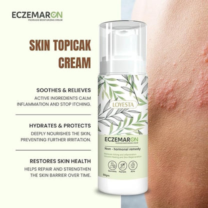 South Moon Psoriasis Moisturizing Cream ( BUY 1 GET 1 FREE )