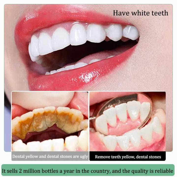 LYDIMOON Whitening toothpaste ( BUY 1 GET 1 FREE )
