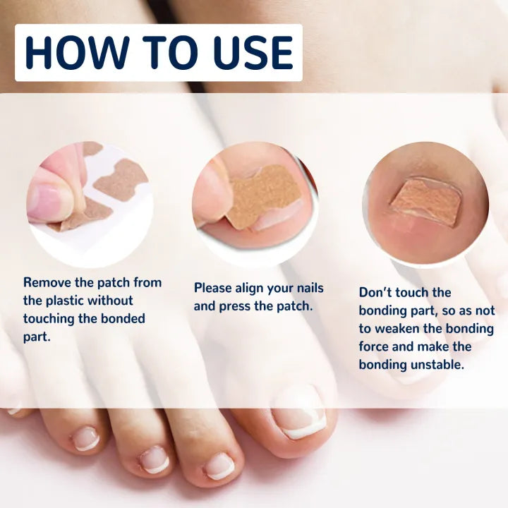 Jaysuing Paronychia Relief Patch ( BUY 1 GET 1 FREE )