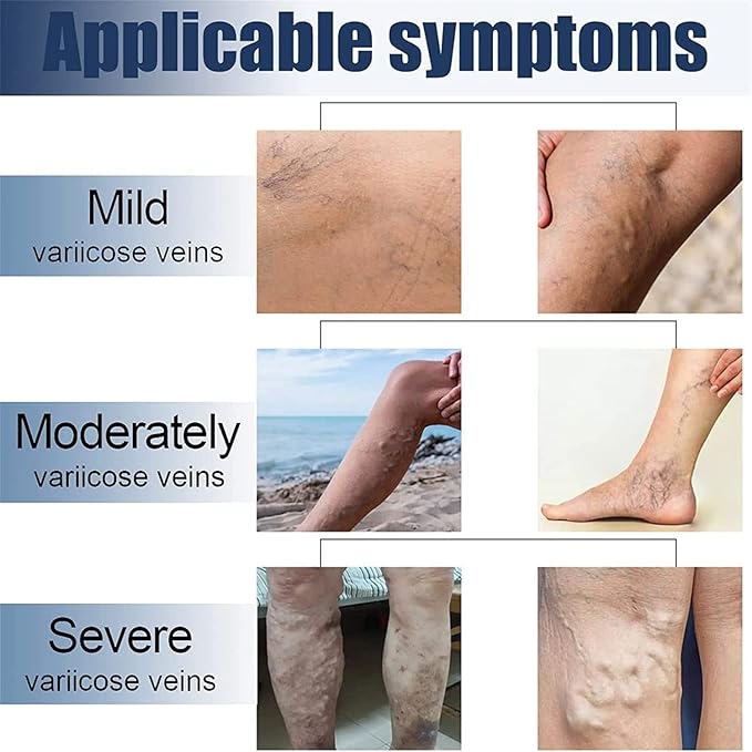 Veinless™ Immediate Relief Patch ( BUY 1 GET 1 FREE )