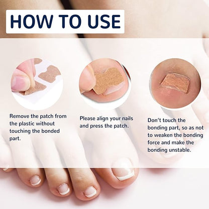 EELHOE™ Toe Nail Correction Patch