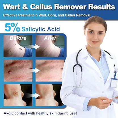 HEALMUSZ™ Wart Remover Liquid – Gentle Skin Renewal Solution