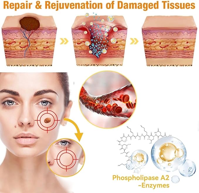 Ximonth  Bee Venom Warts Removal Ointment ( BUY 1 GET 1 FREE )