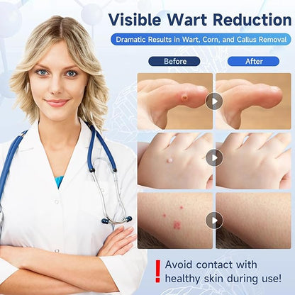 Advanced Formula Maximum  Strength Warts Removal Liquid