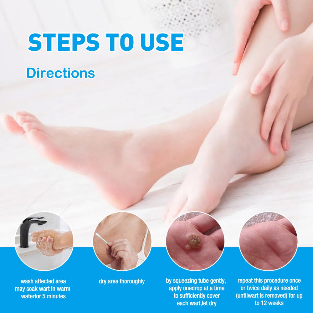 HEALMUSZ™ Wart Remover Liquid – Gentle Skin Renewal Solution