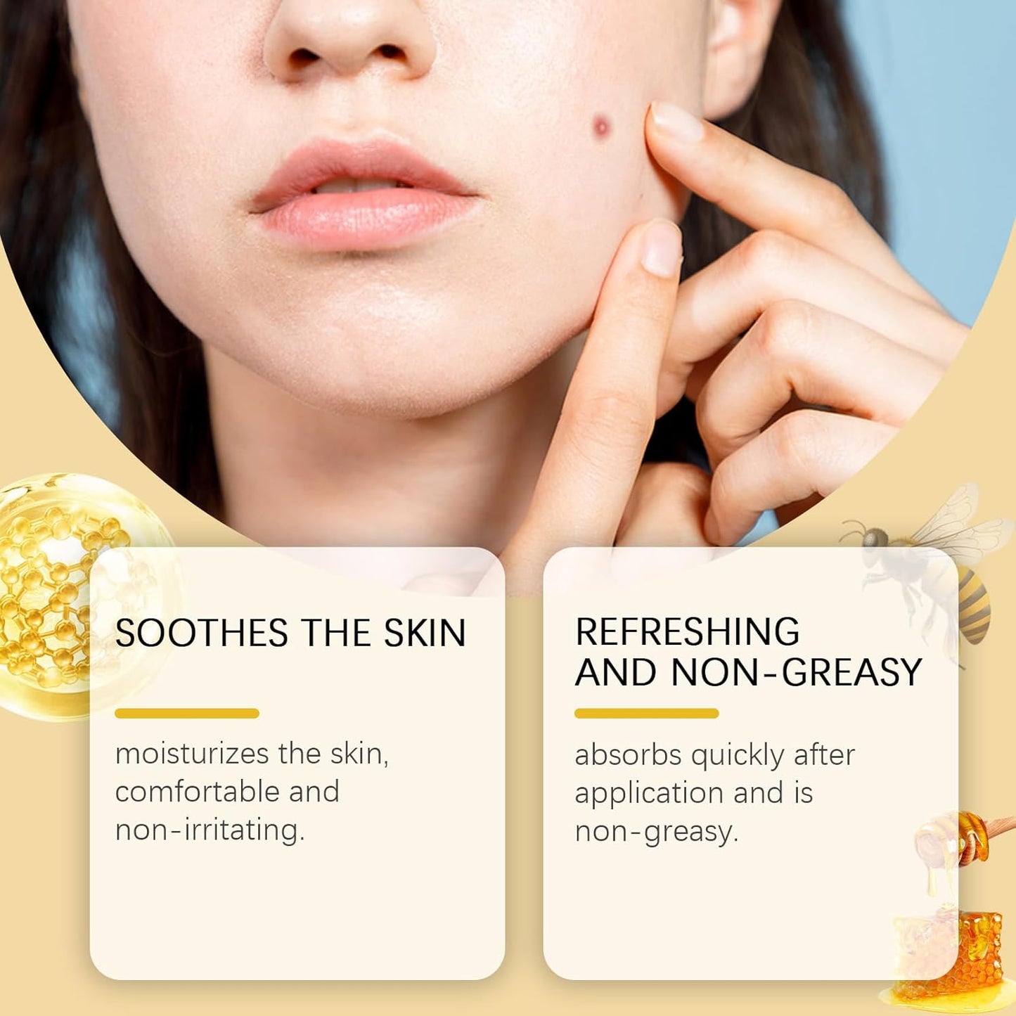 Ximonth  Bee Venom Warts Removal Ointment ( BUY 1 GET 1 FREE )