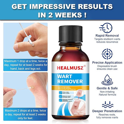 HEALMUSZ™ Wart Remover Liquid – Gentle Skin Renewal Solution