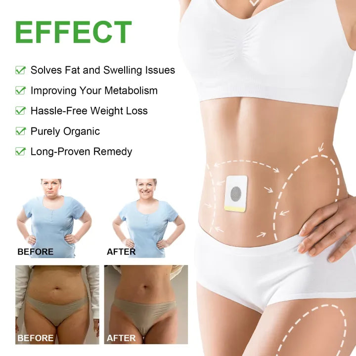 Eelhoe Weight Loss Slimming Patch ( BUY 1 GET 1 FREE )