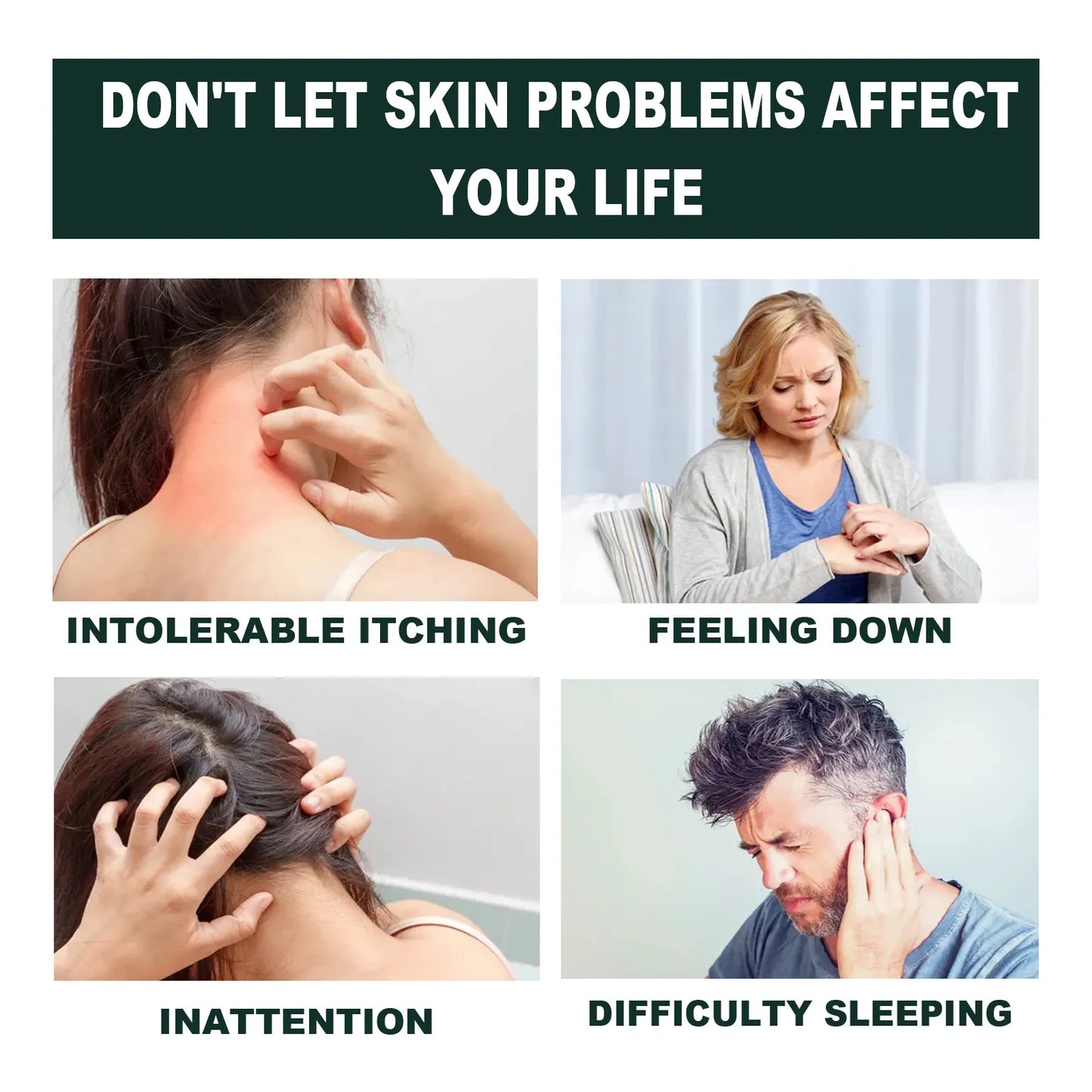 South Moon Psoriasis Cream ( BUY 1 GET 1 FREE )