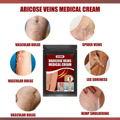 Eelhoe™ Varicose Veins Patches ( BUY 1 GET 1 FREE )