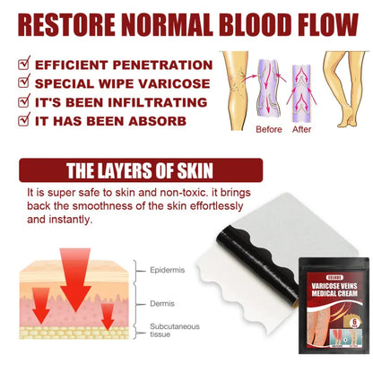 Eelhoe™ Varicose Veins Patches ( BUY 1 GET 1 FREE )