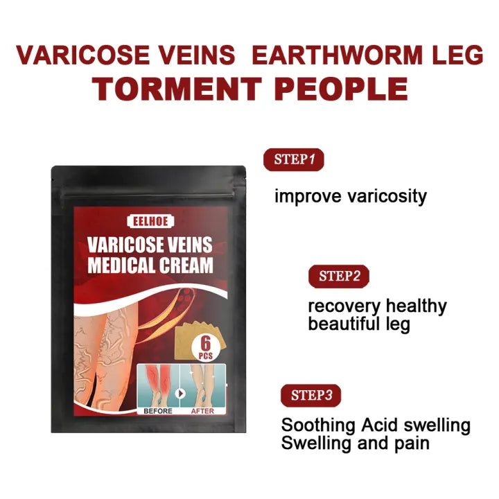 Eelhoe™ Varicose Veins Patches ( BUY 1 GET 1 FREE )