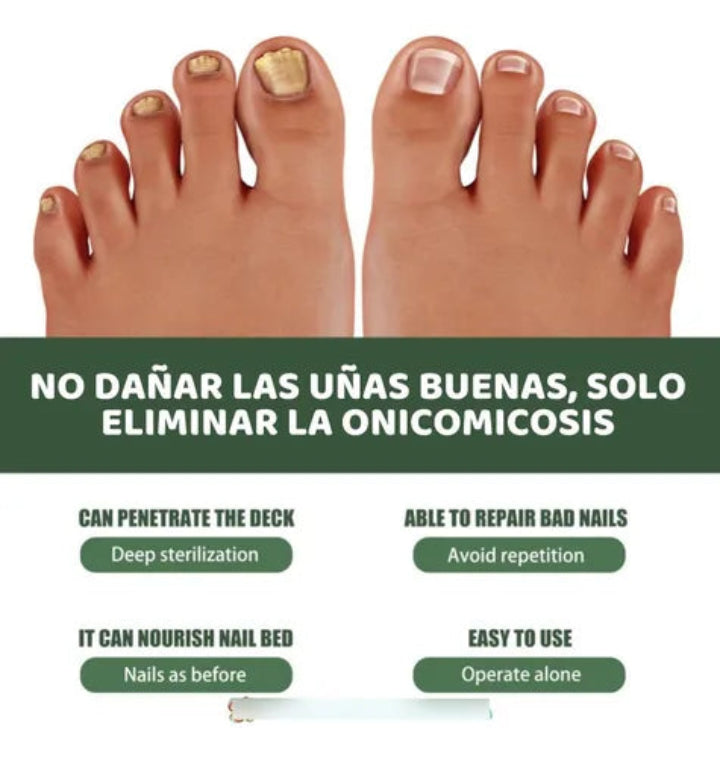 South Moon Anti-fungal Nail Repair Serum Kit