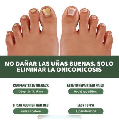 South Moon Anti-fungal Nail Repair Serum Kit