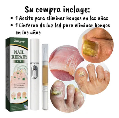 South Moon Anti-fungal Nail Repair Serum Kit