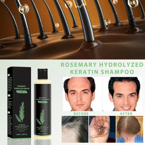 Tgideas Organic Rosemary Hair Growth Shampoo ( BUY 1 GET 1 FREE )