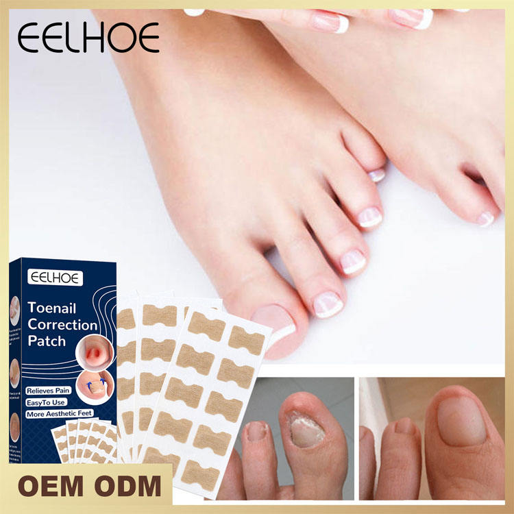 EELHOE™ Toe Nail Correction Patch