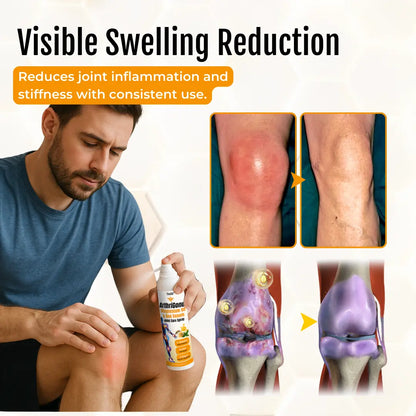 Timilk® ArthriGone Magnesium Oil & Bee Venom Joint Care Spray