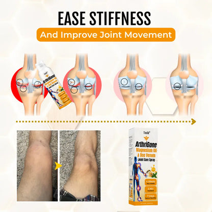 Timilk® ArthriGone Magnesium Oil & Bee Venom Joint Care Spray