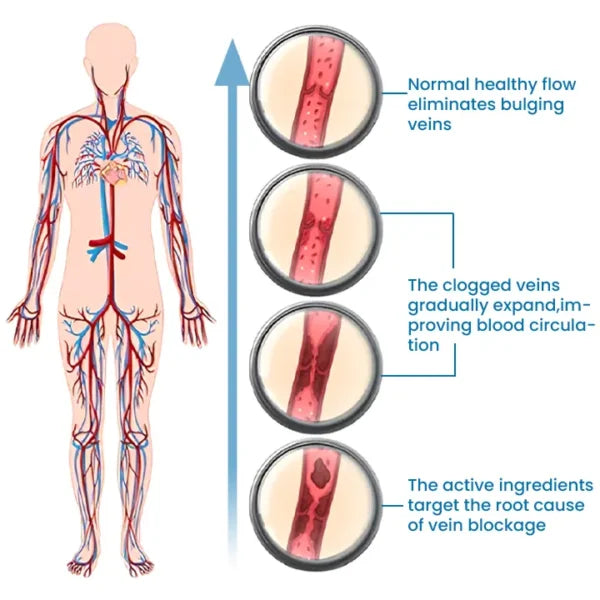 Timilk® VeinFlow Microneedle Repair Patch