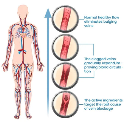 Timilk® VeinFlow Microneedle Repair Patch
