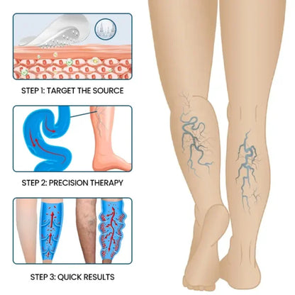 Timilk® VeinFlow Microneedle Repair Patch