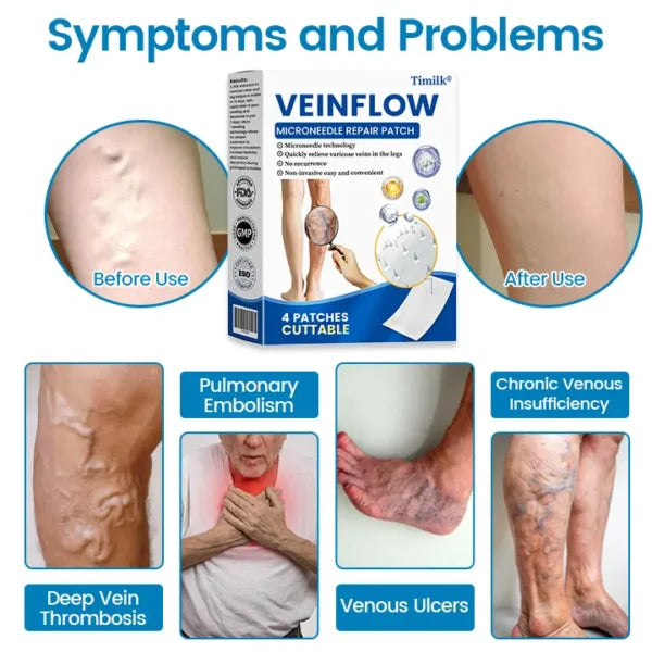 Timilk® VeinFlow Microneedle Repair Patch