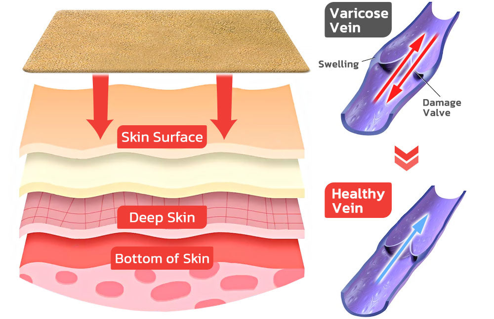Veinless™ Immediate Relief Patch ( BUY 1 GET 1 FREE )